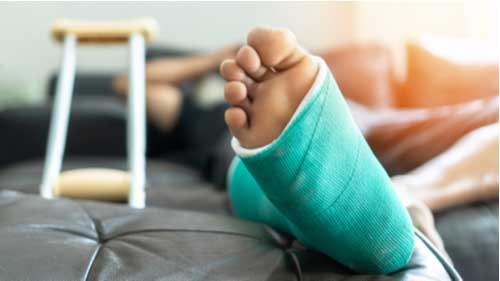 Man with broken leg, Buford personal injury lawyer concept
