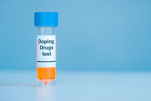 employers have the right to request a drug test after an accident