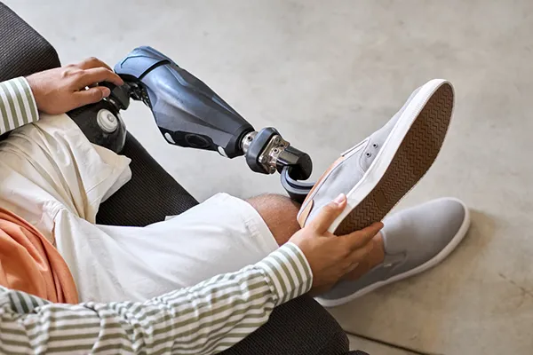Why Choose 1Georgia Personal Injury Lawyers for Your Loss of Limb Case