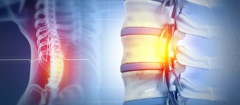 spinal cord injury and pain