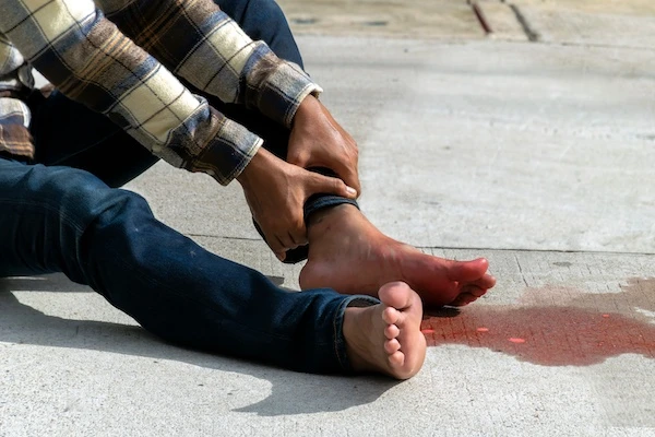 A person's foot is bleeding from an accident and requires a pedestrian accident lawyer.
